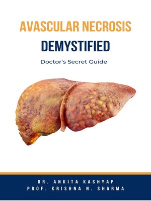 cover image of Avascular Necrosis Demystified